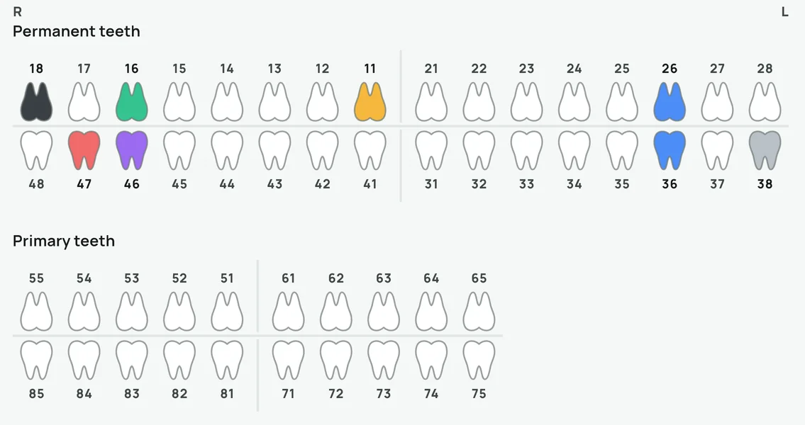 Zabcho's tooth chart: permanent and primary teeth colored by condition.